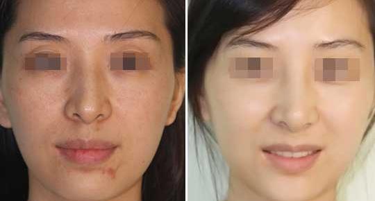 清潔美容儀多少錢一臺（圖）_1