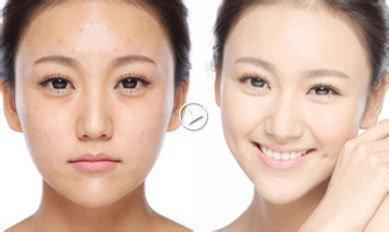 清潔美容儀多少錢一臺(圖)_3