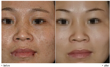 清潔美容儀排行榜（圖）_1