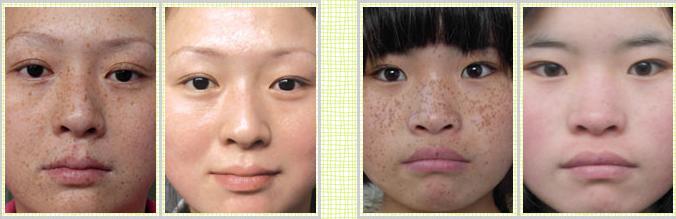 清潔美容儀排行榜（圖）_4