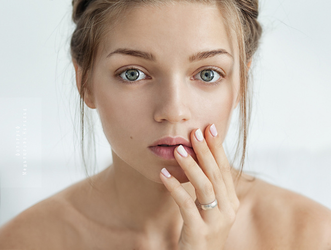 激光祛斑儀器有哪些（圖）_1