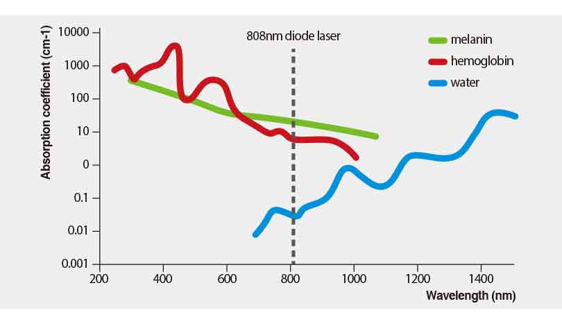 HR808半導(dǎo)體激光脫毛儀器價格（圖）_3