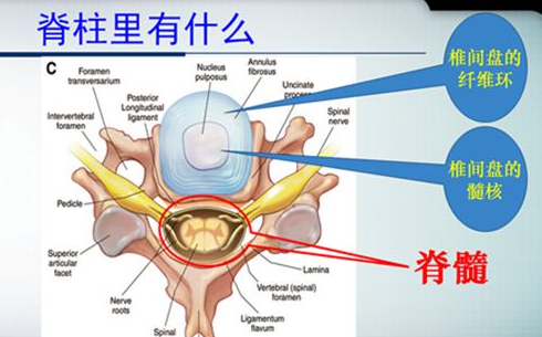 治腰間盤突出最好的方法不是手術(shù)是保守改善（圖）_1