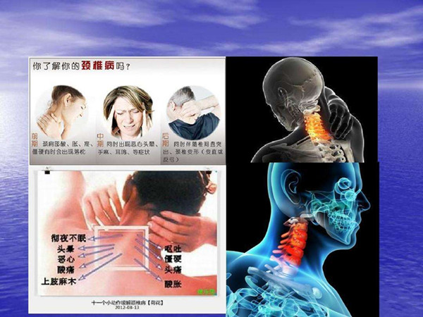 避免改善頸椎病陷入誤區(qū)應(yīng)該這樣改善好（圖）_1