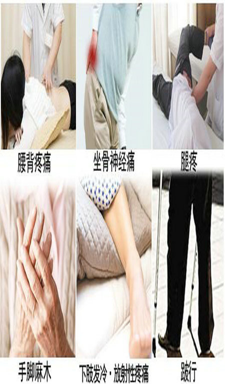 王九正黑膏藥_1