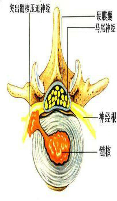 2018膏藥排行榜王九正代理拿貨價(jià)格是多少_1
