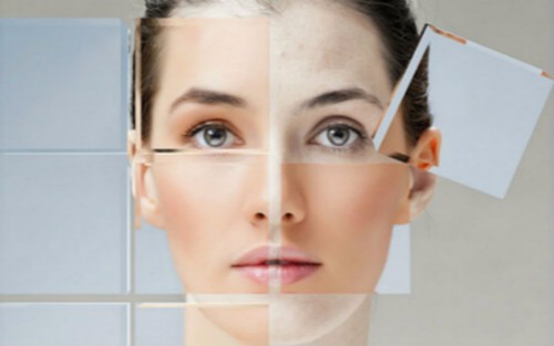 什么方法祛斑最有效呢?fù)?jù)說(shuō)這樣祛斑效果好（圖）_2