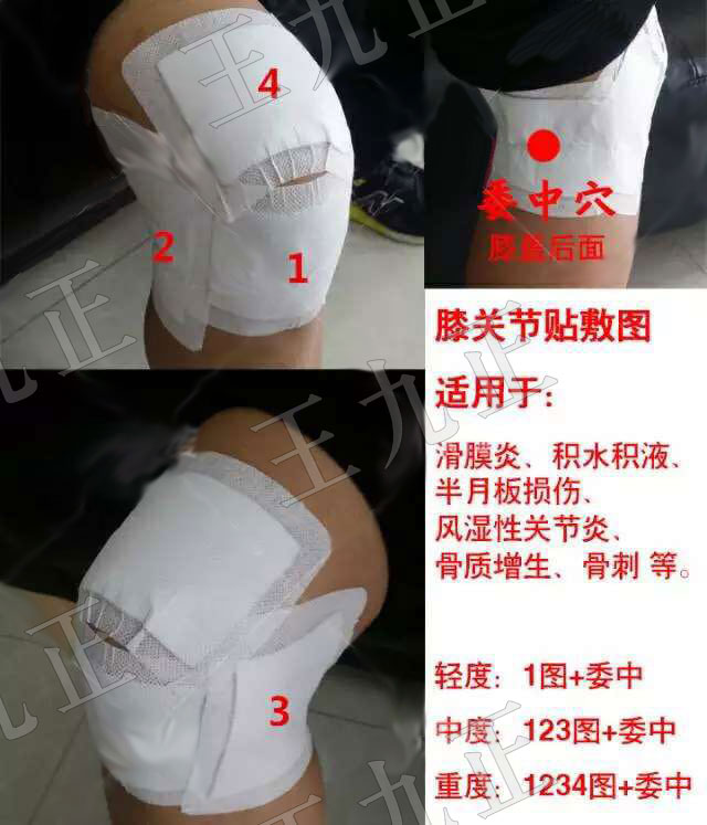 市場(chǎng)膏藥品種那么多選擇王九正的理由是什么_1