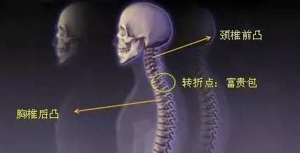 肩颈疼痛，胸闷心慌是怎么了，快把你的包丢掉！！！（图）_1