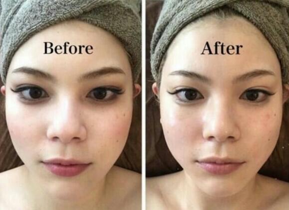 日式整骨有哪些作用？做日式整骨疼嗎？_1