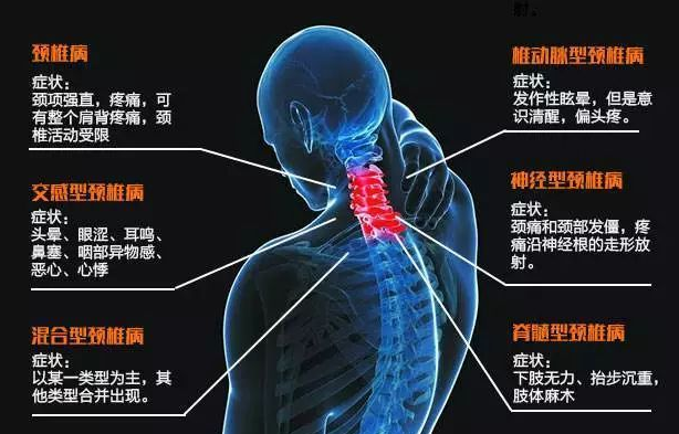 揭秘颈椎病该怎么办？用膏药外贴治吧（图）_1