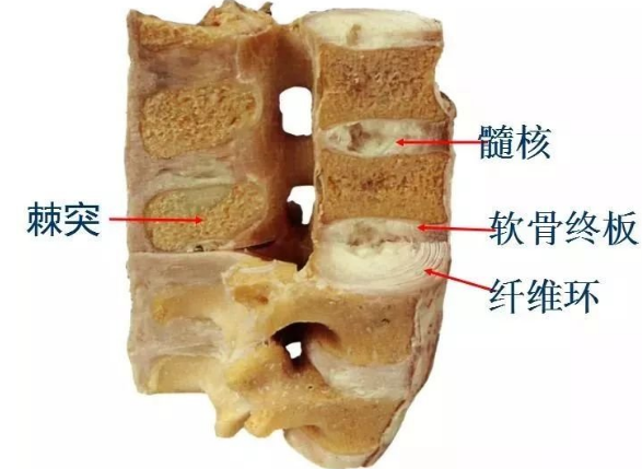 原来这是腰突的表现别怪我没提醒你（图）_2