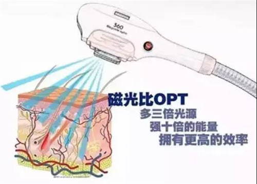 强烈推荐！脱毛就认准绿瘦美学馆360磁光嫩肤仪_4