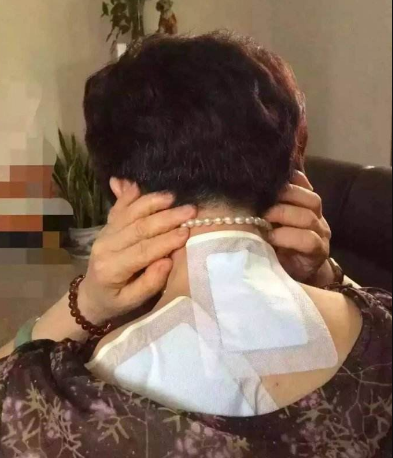 頸椎病在眾多改善方法中你選擇哪個了（圖）_3