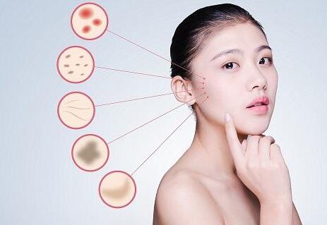 激素性皮炎怎么根治？氧趣臭氧膏改善激素性皮炎怎么樣？（圖）_2