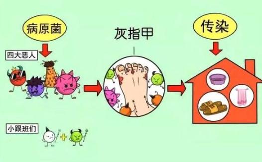 氧趣臭氧膏为什么可以治愈灰指甲？（图）_3